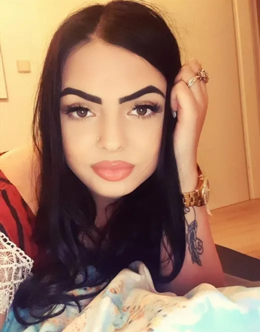 random escort 9